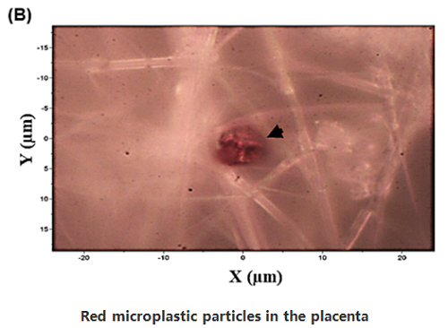 Red microplastic particles in the placenta